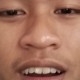 Abdi
